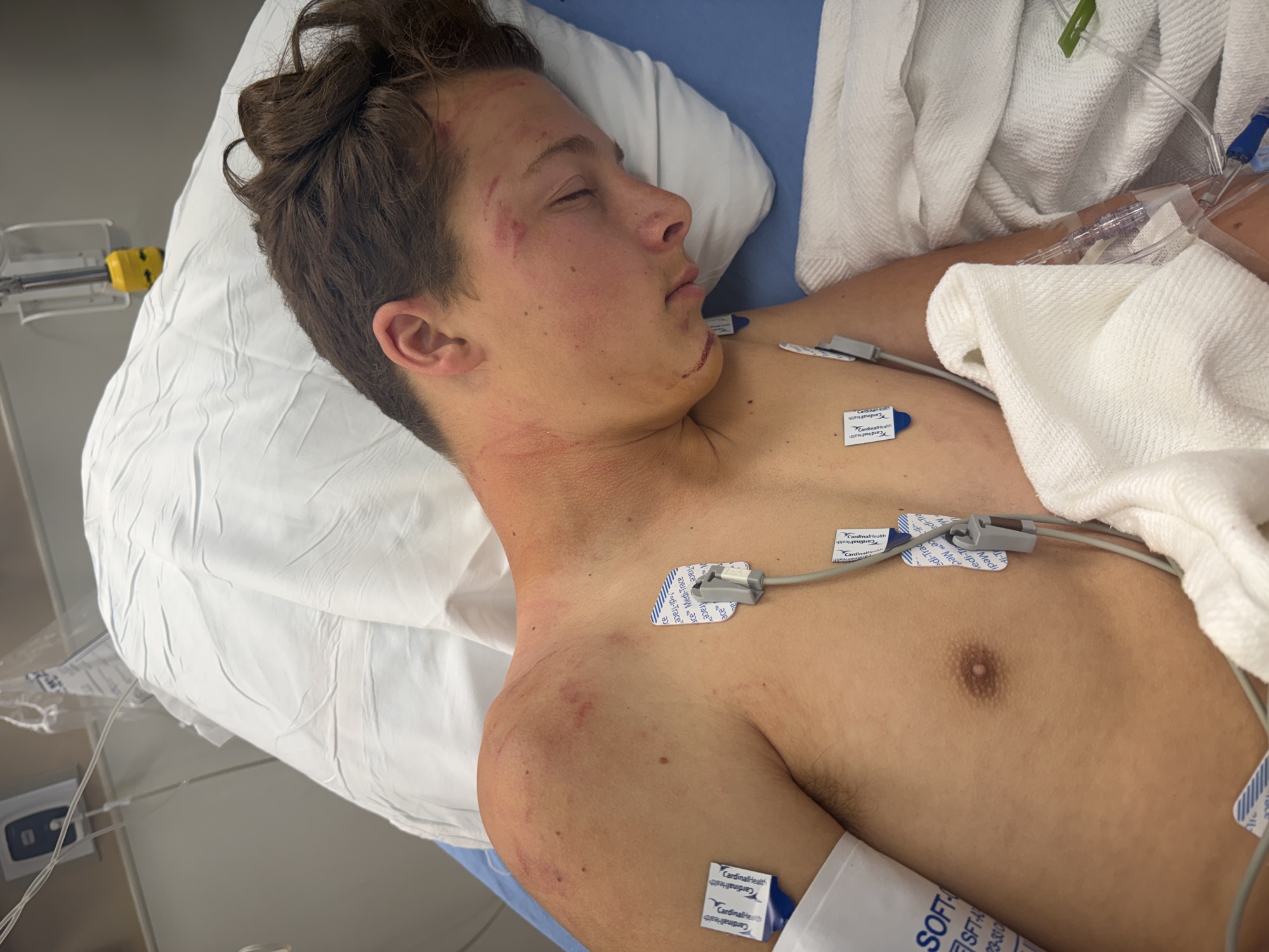 Brady in the hospital after the crash